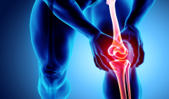 knee-osteoarthritis