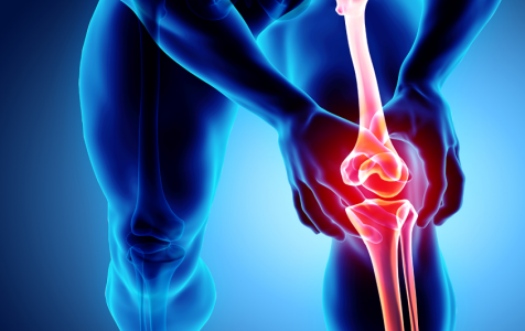 knee-osteoarthritis